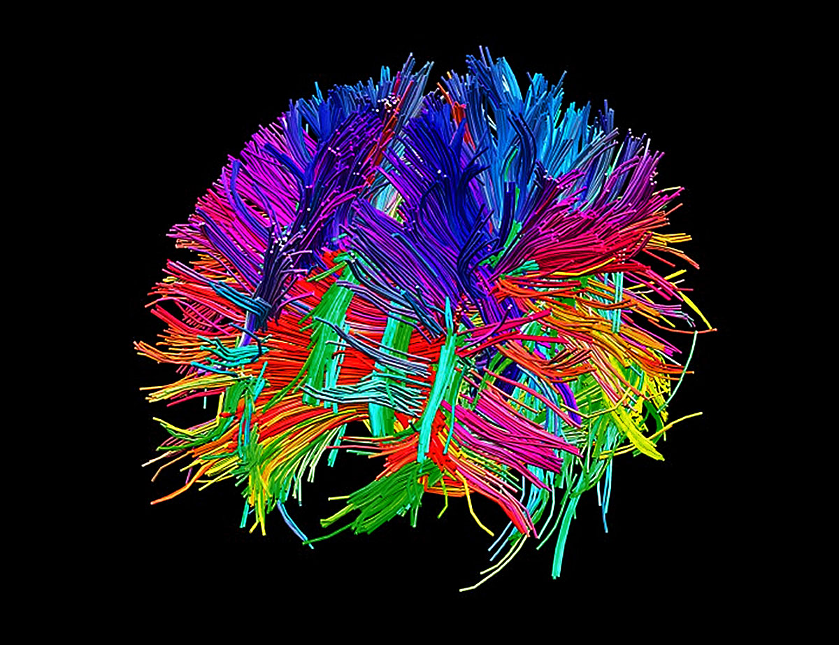 Az új szőttesszerű agyi szerkezet modellje