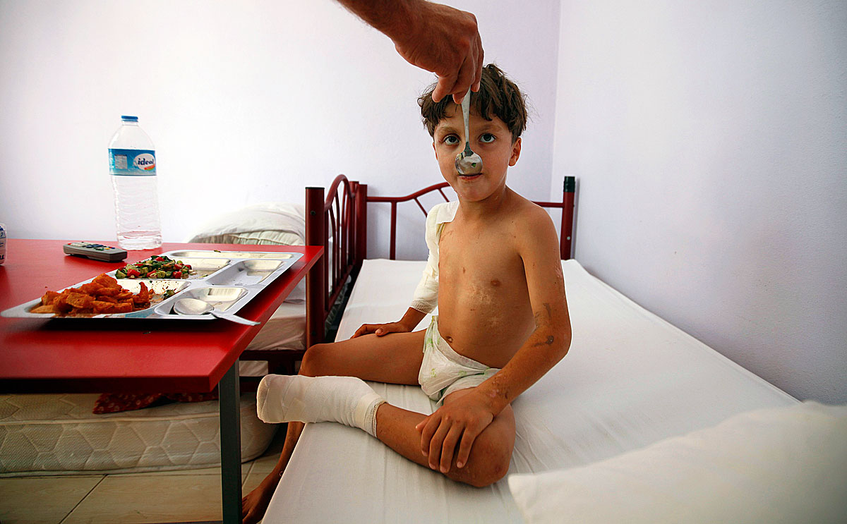 Zakaria, 10, an injured Syrian refugee boy, is fed by a nurse as he undergoes rehabilitation at a post traumatic care centre directed by Union of Syrian Medical Relief Organizations (UOSSM) in Hatay province August 13, 2012. Zakaria is the only survi