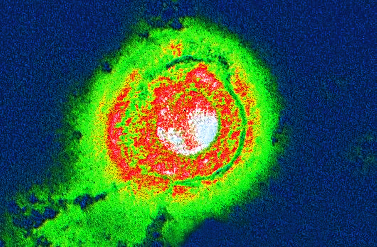 Citomegalovírus elektronmikroszkópos felvételen