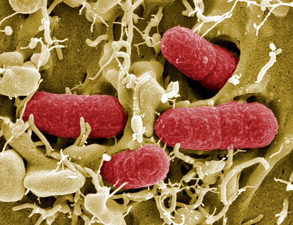 Az E. coli bélbaktérium egyik típusának számító EHEC nagyon agresszív