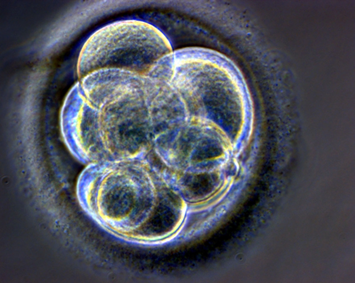 Kezdeti stádiumban lévő osztódó emberi embrió. Mire használhatók az ilyen eredetű sejtkultúrák? 