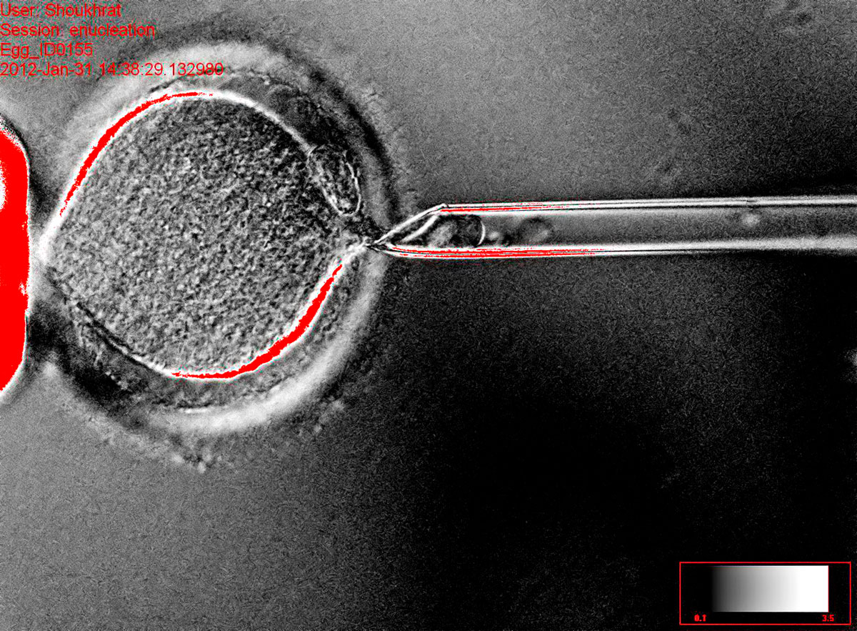 Egy emberi bőrsejt sejtmagját petesejtbe ültették, amely embrióvá fejlődött