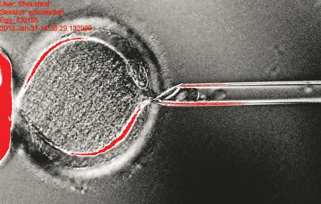 Egy emberi bőrsejt sejtmagját petesejtbe ültették, amely embrióvá fejlődött