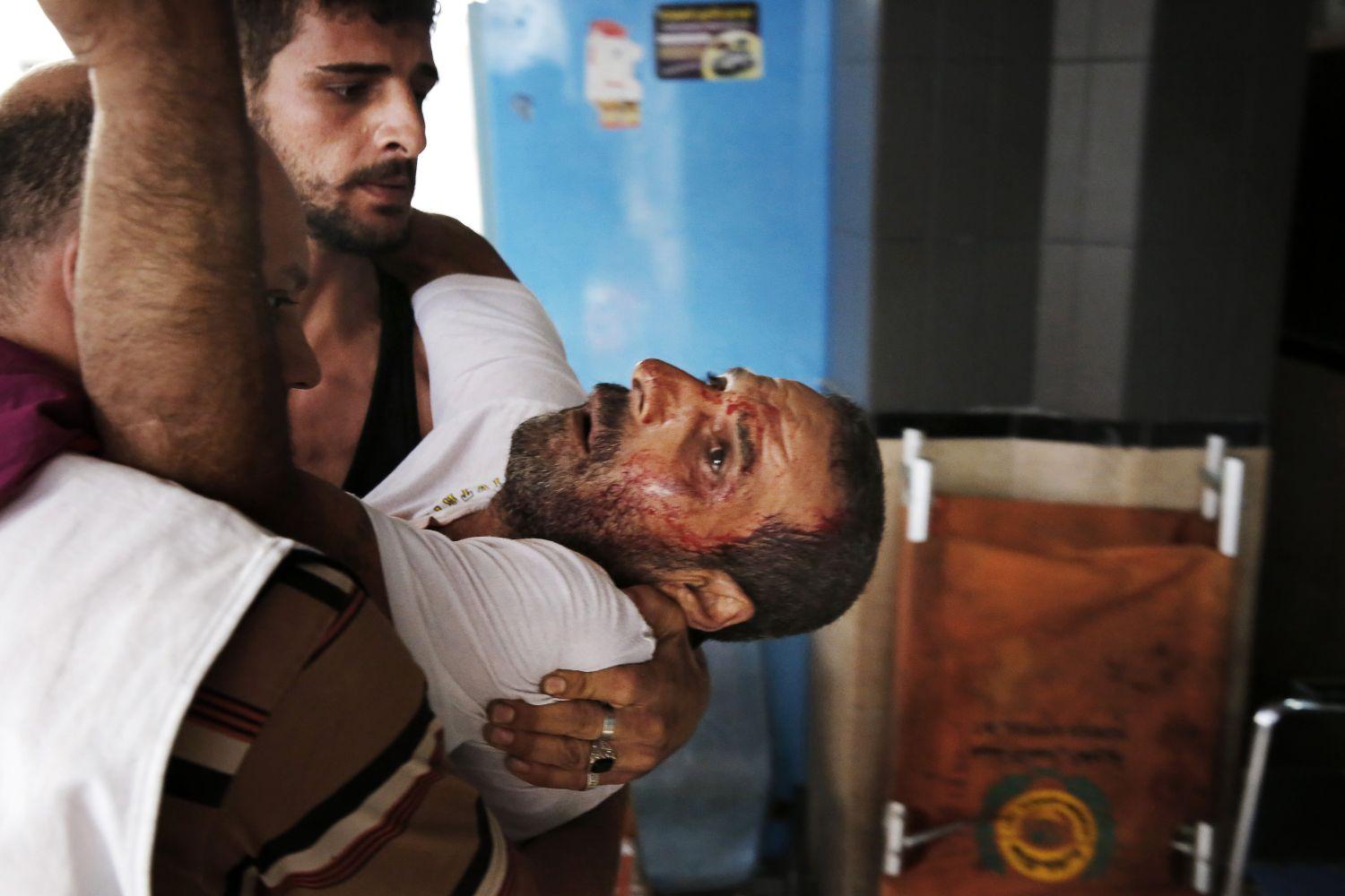 Sebesült palesztin férfit szállítanak be a kórházba
