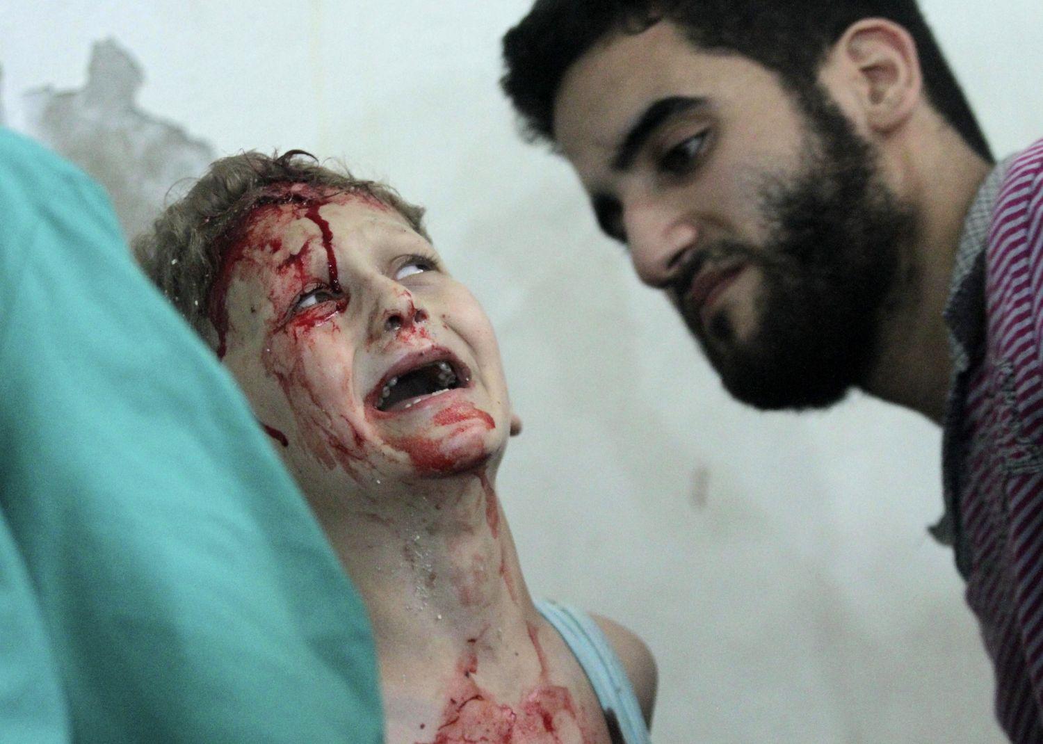 Sebesült fiú a szír kormányerők egyik júliusi támadása után a Damaszkusz melletti Gutában