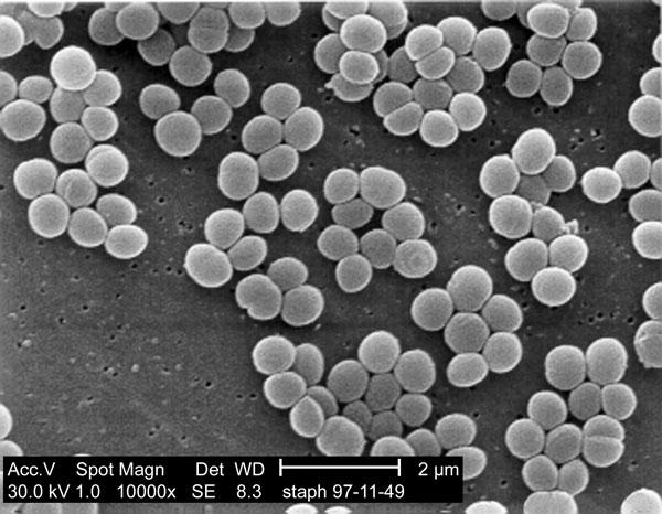 A Staphylococcus aureus az egyik leggyakoribb gennykeltő baktériumnak tekinthető, de jelentős szerepet játszik az ételmérgezésekben és kórházi járványokban is
