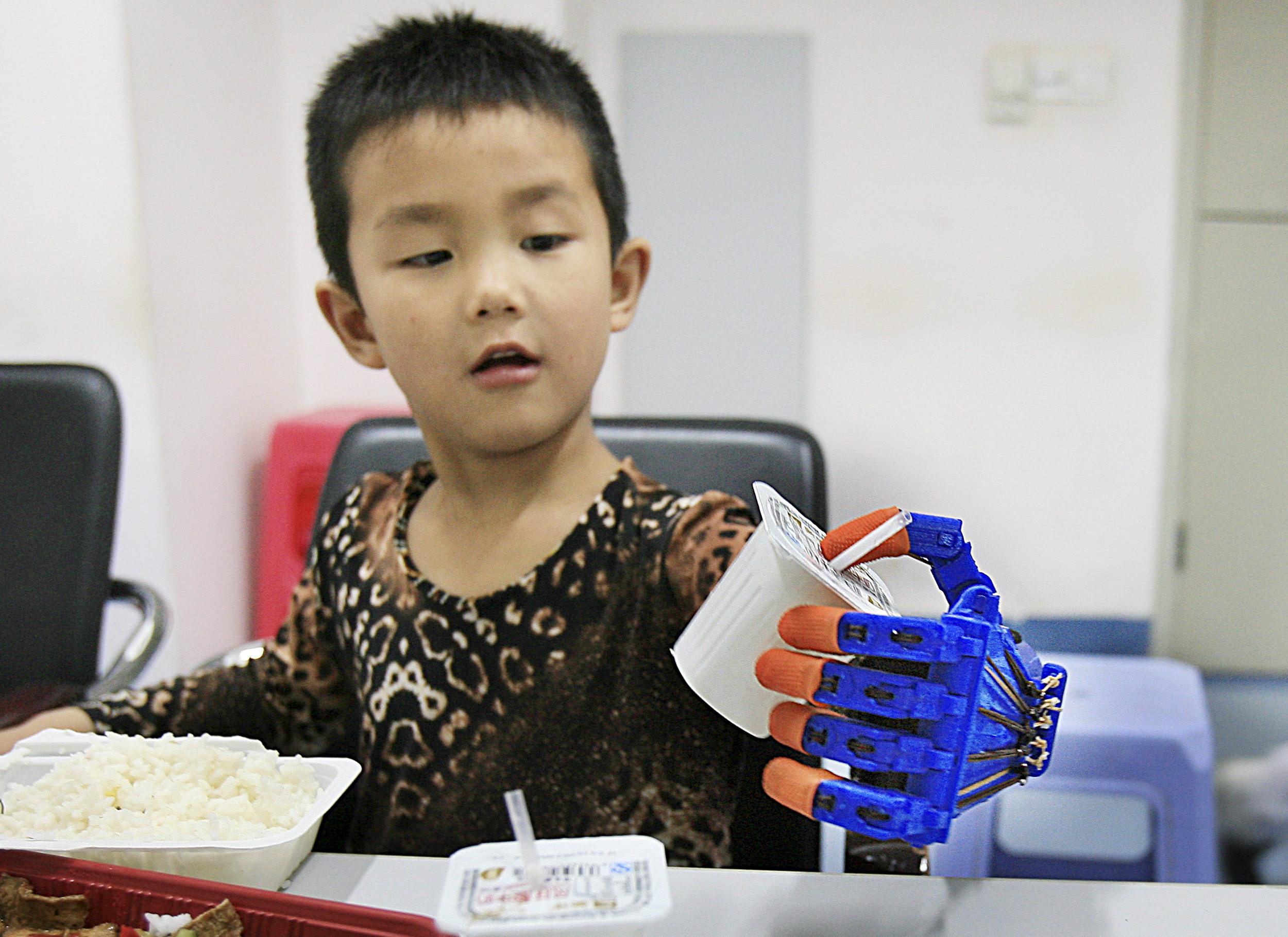 Egy hatéves kínai kisfiú, Hsziaocseng, akinek egy autóbaleset miatt négyévesen amputálták a bal karját. A terv az, hogy az amputáció után megmaradt idegeket sikerüljön a protézisen át stimulálni