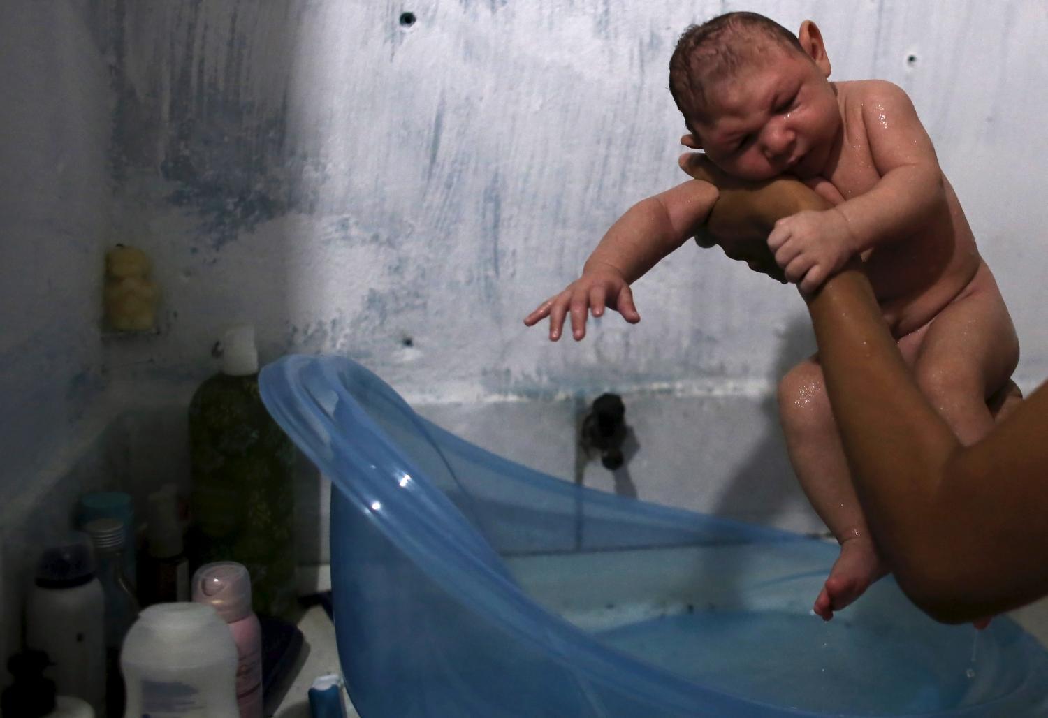 Juan Pedro egyike annak a több mint 4000 babának, aki mikrokefáliával született Brazíliában