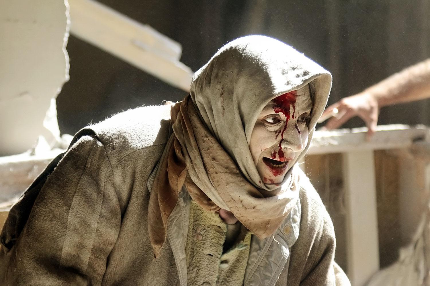 Homlokán sebesült asszony Aleppó óvárosában 