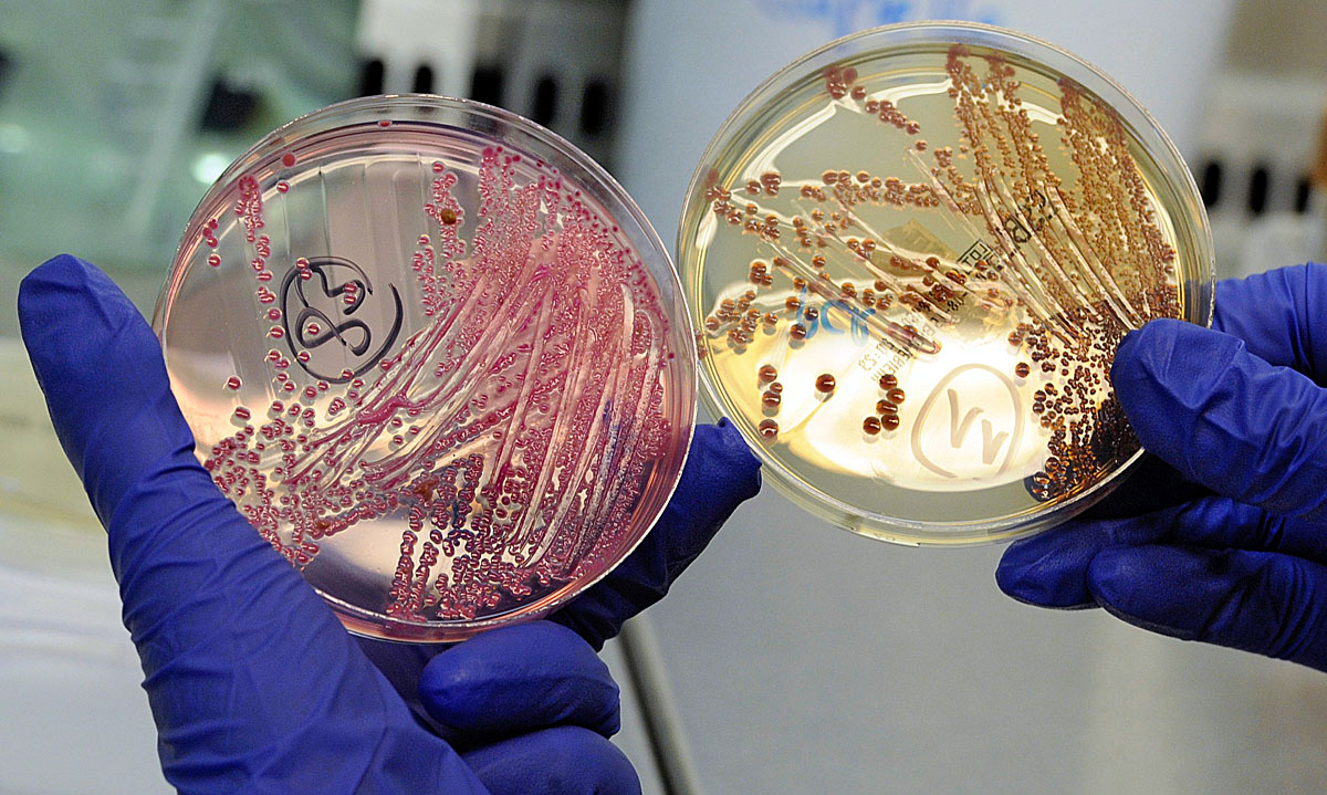 EHEC-coli baktériumtörzsek a hamburgi egyetemi klinika munkatársának kezében
