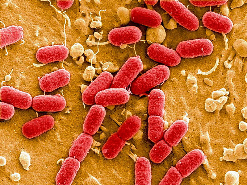 A kórokozó „esztétikája” – így néz ki a mostani német járvány mutáns kólibaktériuma elektronmikroszkóp alatt