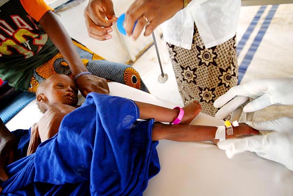 Infúzióval táplálnak egy nigeri kisgyereket
