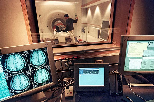 Az fMRI-vel érzékelhetõ az áramló vér mennyisége
