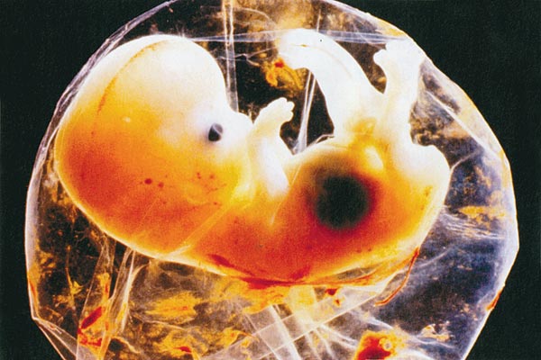 Az ölõsejtek az embriót mint idegen testet érzékelik