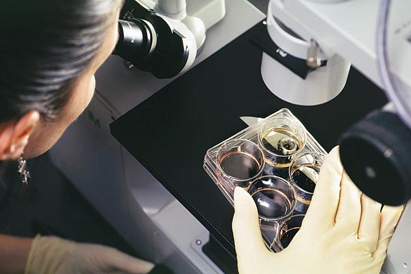 Emberi embrionális õssejtek vizsgálata mikroszkóp alatt