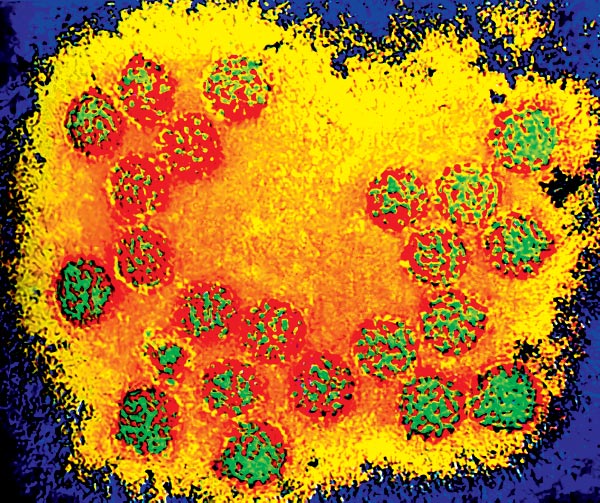 A HPV víruscsalád egyik tagja - Több mint száz változat létezik