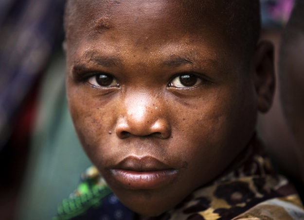 Menekült fiú Kelet-Kongóban