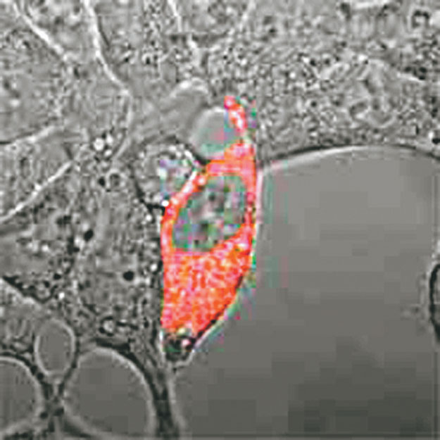 A sejtbe juttatott fluoreszcens nanoszenzor eltérő színnel jelzi a nátrium jelenlétét