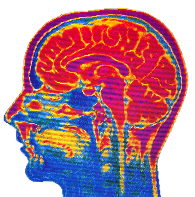 Az MRI-felvétel kimutatja az agyban az érzelmi folyamatokat is