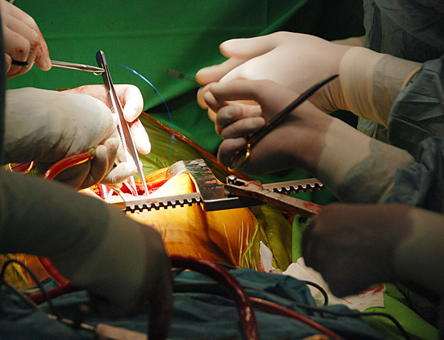 Dr. Szatmári András műtétet vezető sebész felvétele Lara szívátültetéséről