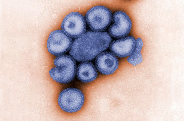 Íme, a sertésinfluenza vírusa
