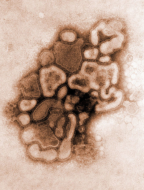 A H1N1-vírus