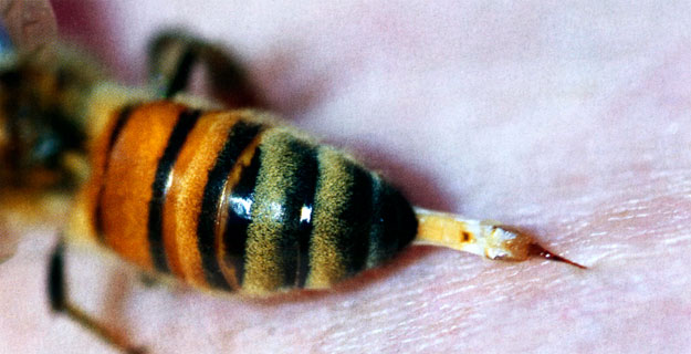 Ha beválik a mesterséges antitest, szegény méhek szúrása mit sem ér majd...