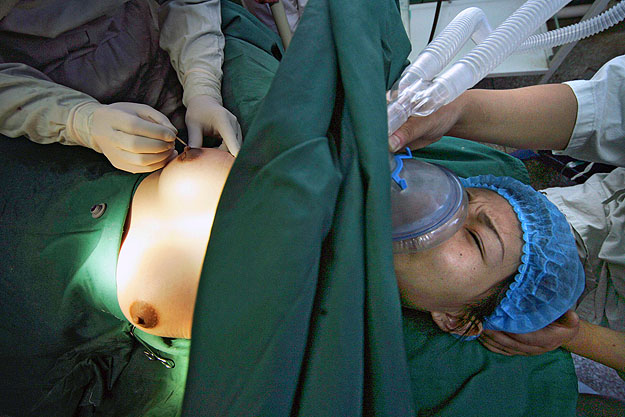 Egy 25 éves kínai transznemű, Jing Jing, a női nem felé tartó tíz műtéti beavatkozás egyikén Tianjin kórházában